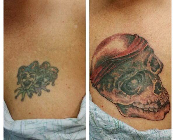 Skull Coverup